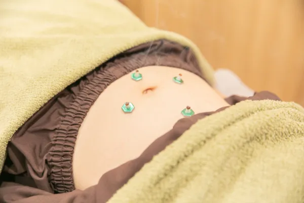 鍼灸施術アイコン