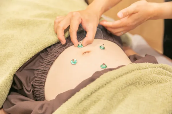 cuna鍼灸整骨院でのお灸の様子